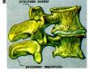 Nombre del archivo=Artrose.JPG
Tamaño del archivo=19KiB
Dimensiones=324x267
Fecha añadida=Enero 19, 2007 Artrose.JPG